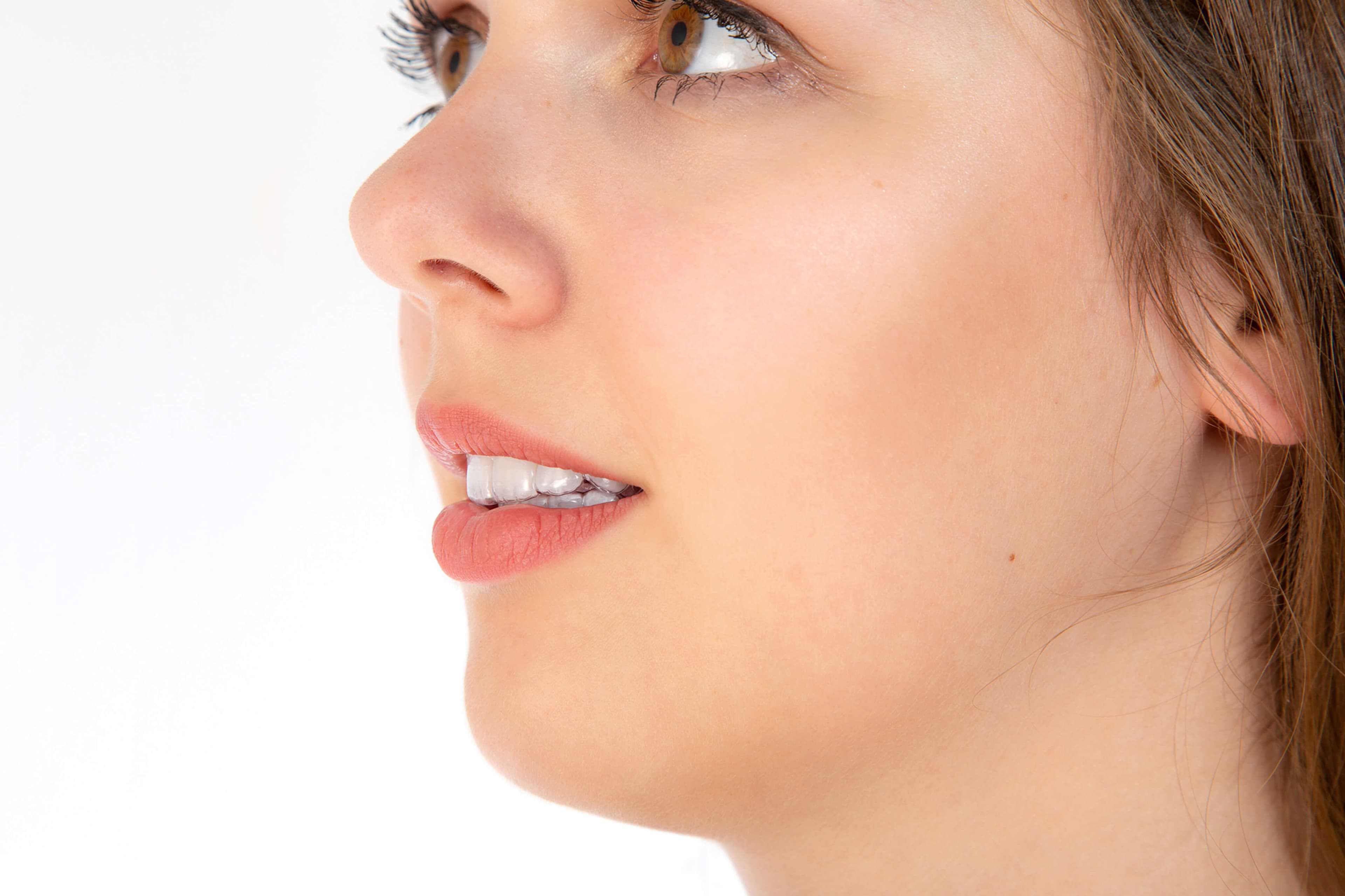 Organical Aligner — Behandlungsergebnis