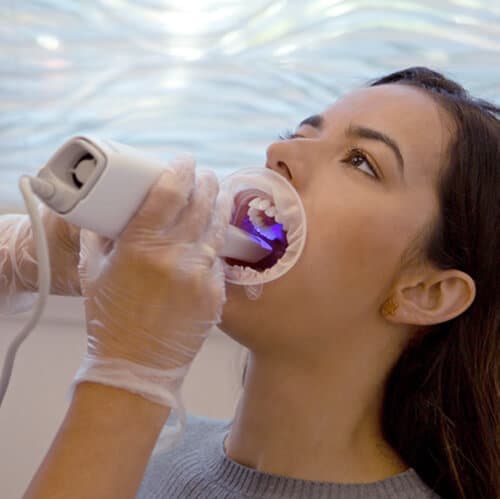 Digitaler Intraoralscan in der Praxis